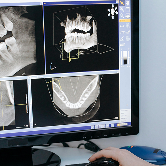 Computer screen showing x rays and models of a patient's jaws