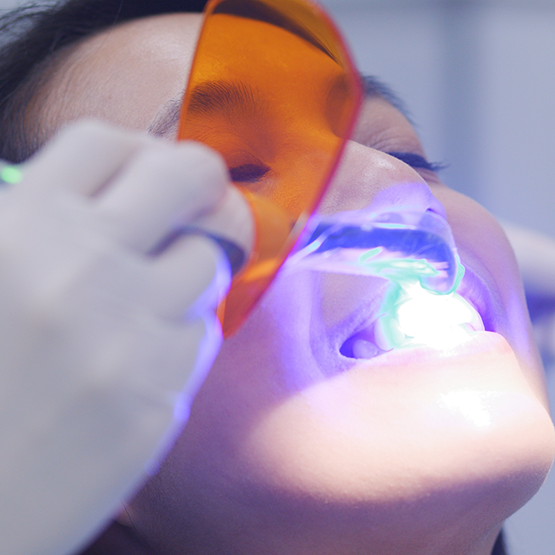 Dental patient having an ultraviolet light shone onto their tooth