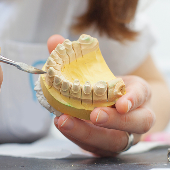 Dentist holding a model of an arch of teeth