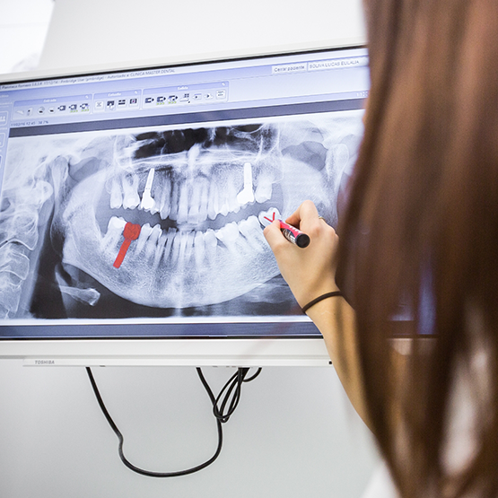 Dentist showing a patient an x ray of their teeth