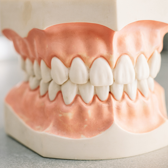 Close up of a model of full dentures