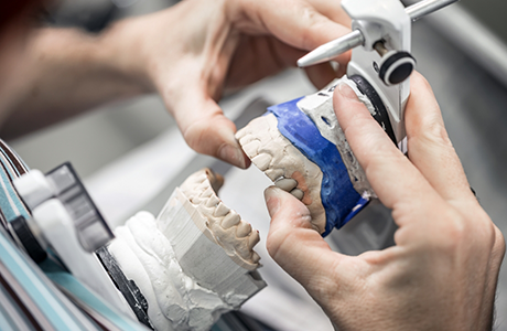 Dental professional adjusting a set of dentures