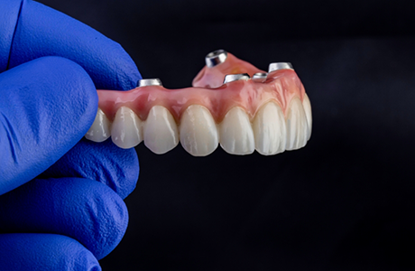 Gloved hand holding an implant denture