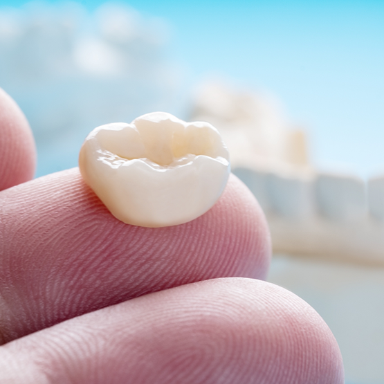 Close up of a tooth colored dental crown on a finger