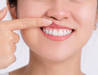 We treat gum disease near Hendersonville