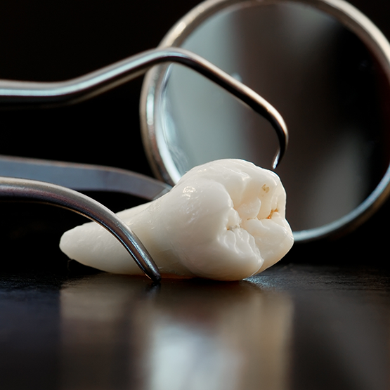 Close up of tweezers holding an extracted tooth